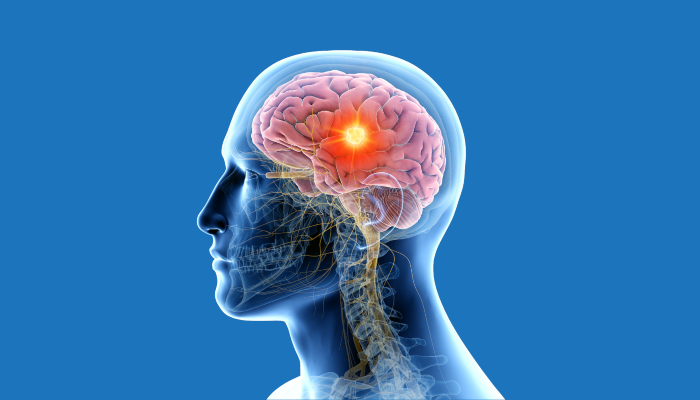 New Research: ब्रेन ट्यूमर के खतरे को बढ़ा रहा वायु प्रदूषण