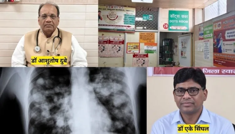 केवल एक्स-रे के भरोसे न करें टीबी (TB Diagnosis) का इलाज, 30 फीसदी मामलों में हो रही चूक