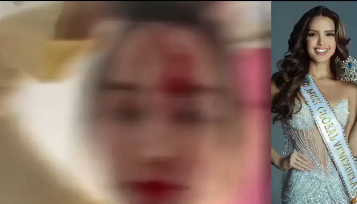 कान्स फिल्म फेस्टिवल के दौरान होटल में खून से लथपथ दिखीं एंड्रिया वाल