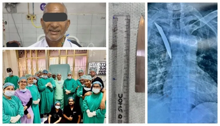 KGMU Trauma Surgery: केजीएमयू के डॉक्टरों ने छाती में चाकू धंसे मरीज की बचाई जान, सुपीरियर वेना कावा की जटिल सर्जरी सफल