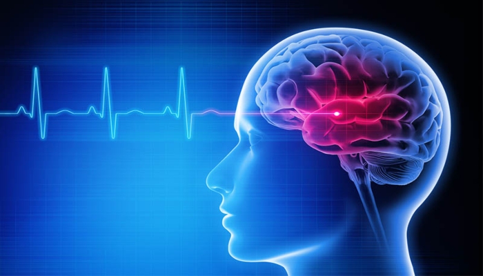 विश्व स्ट्रोक दिवस 2025: ब्रेन स्ट्रोक से बचाव के लिए जीवनशैली में बदलाव जरूरी