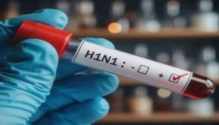 KGMU: H1N1 मौसमी इन्फ्लुएंजा है, नया स्ट्रेन नहीं मिला