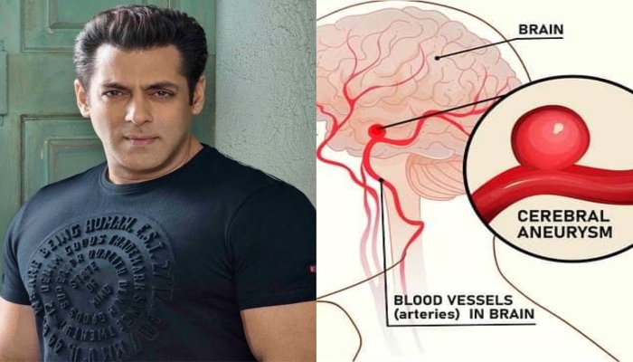 Salman Khan Health Revelation : सलमान खान का सेहत को लेकर चौंकाने वाला खुलासा, अब चलने-फिरने में भी हो रही समस्या