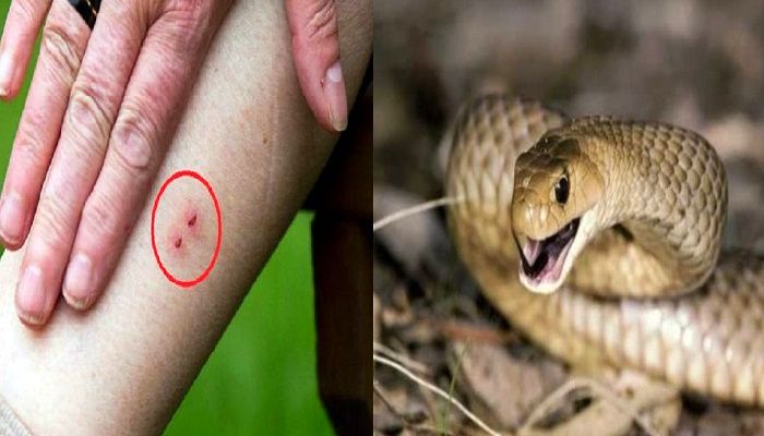 Hooghly Snakes:  सांपों का आतंक,  छह महीने में 500 से ज्यादा लोगों को काटा