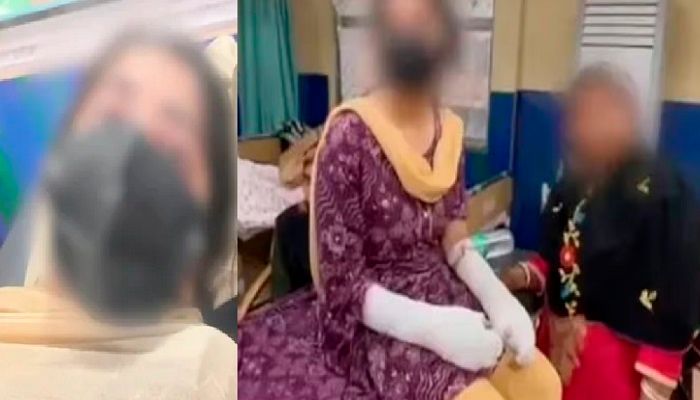 Delhi Acid Attack: दिल्ली एसिड अटैक केस में चौंकाने वाला खुलासा, पिता ही निकला मास्टरमाइंड