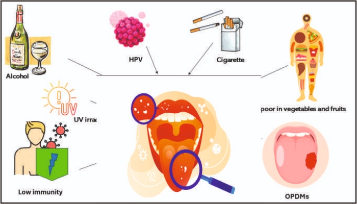 भारत में मुंह के कैंसर की बढ़ती चुनौती: शराब और धुआं रहित तंबाकू सबसे बड़ा कारण